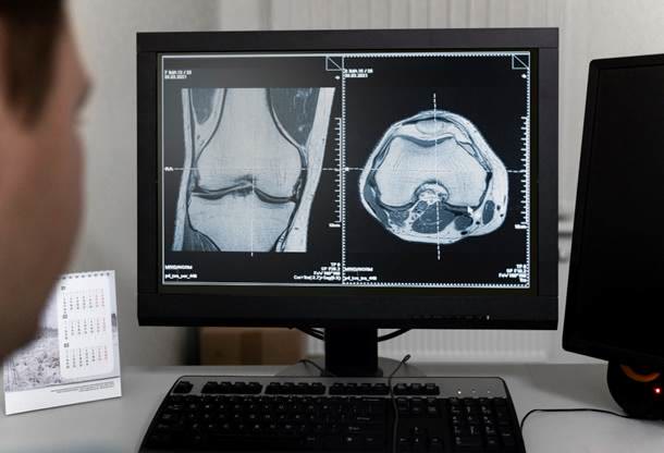 Understanding Digital X-Rays: What Patients Need to Know