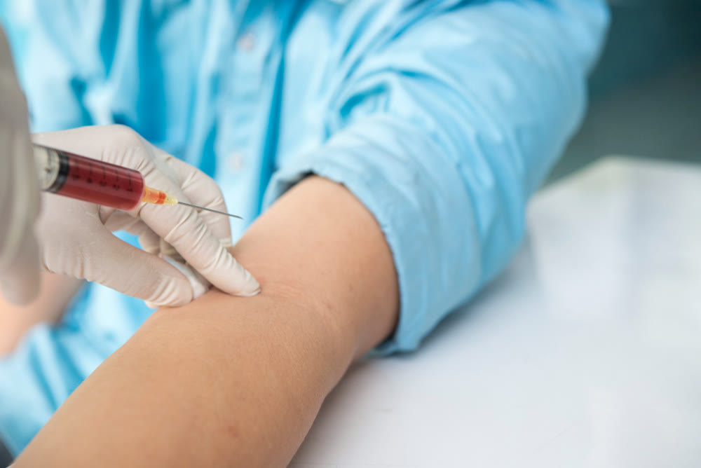 What is the Glycated Hemoglobin Test (HbA1c) and Why Is It Important for Diabetes Management?